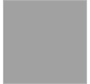 Кронштейн МТЗ пружини зчеплення (старий зразок) (вир-во МТЗ) 50-1602034